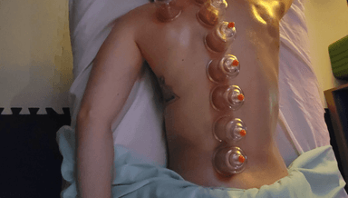 Image for 45 min Dynamic Cupping massage therapy